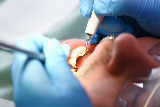Best Emergency Root Canal Treatment in Port Morris, NJ